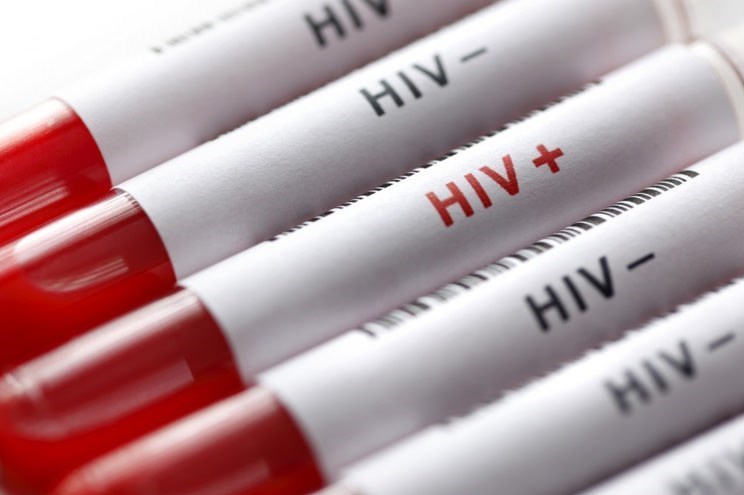 وجود ۲۳۹۰۲ مبتلا به HIV در ایران/ ۸۱درصد مبتلایان مرد هستند