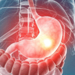 وزارت بهداشت: نیمی از سرطانها کاملا قابل پیشگیری هستند وزارت بهداشت: نیمی از سرطانها کاملا قابل پیشگیری هستند